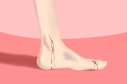 女人梦到摔倒是什么意思 有什么含义吗