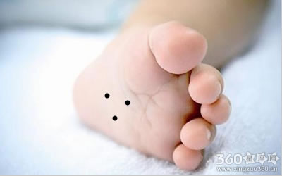 脚底长痣是什么意思 三颗痣好吗